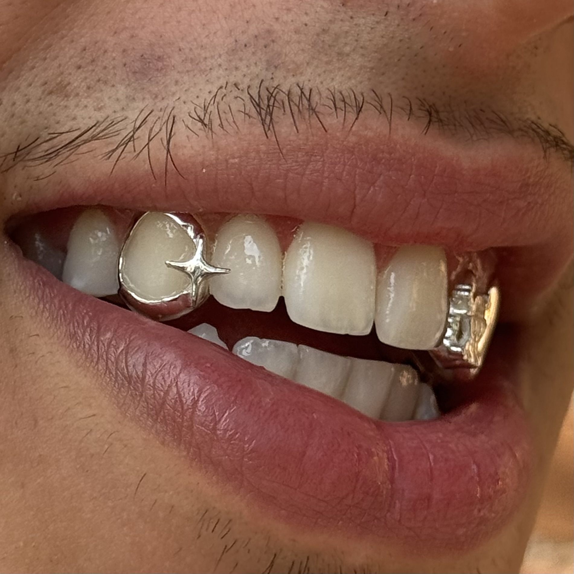 Mini star grillz - Photo 1