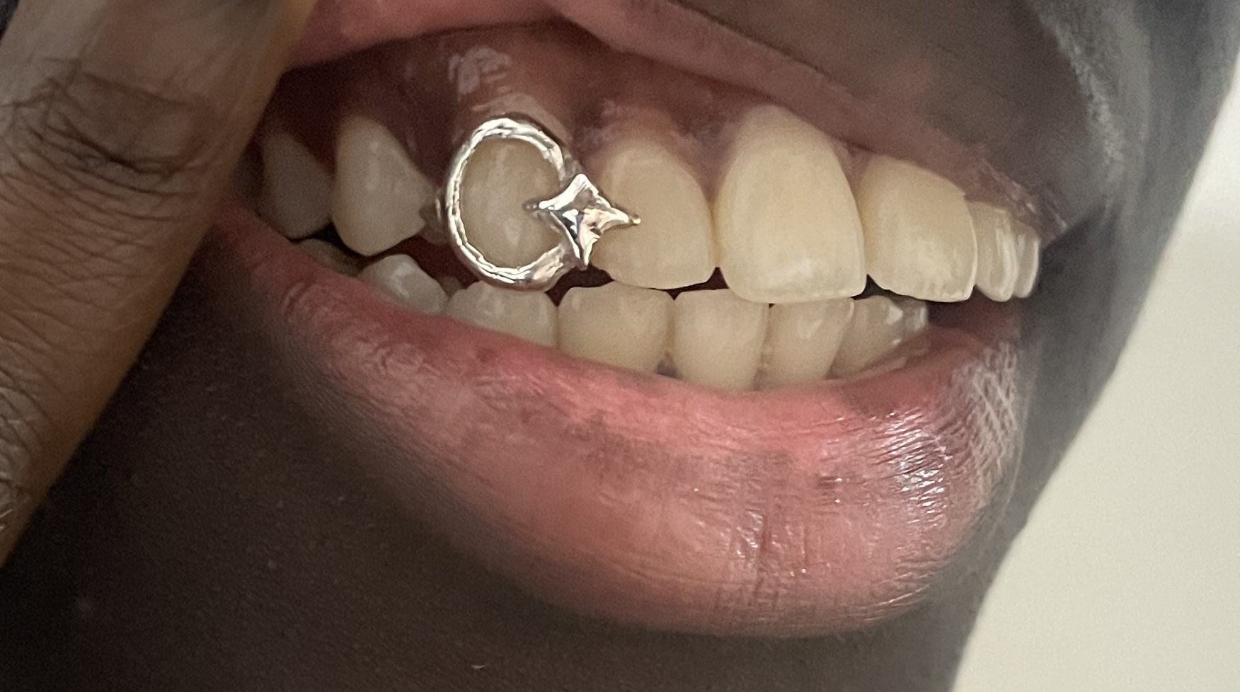 Mini star grillz - Photo 2