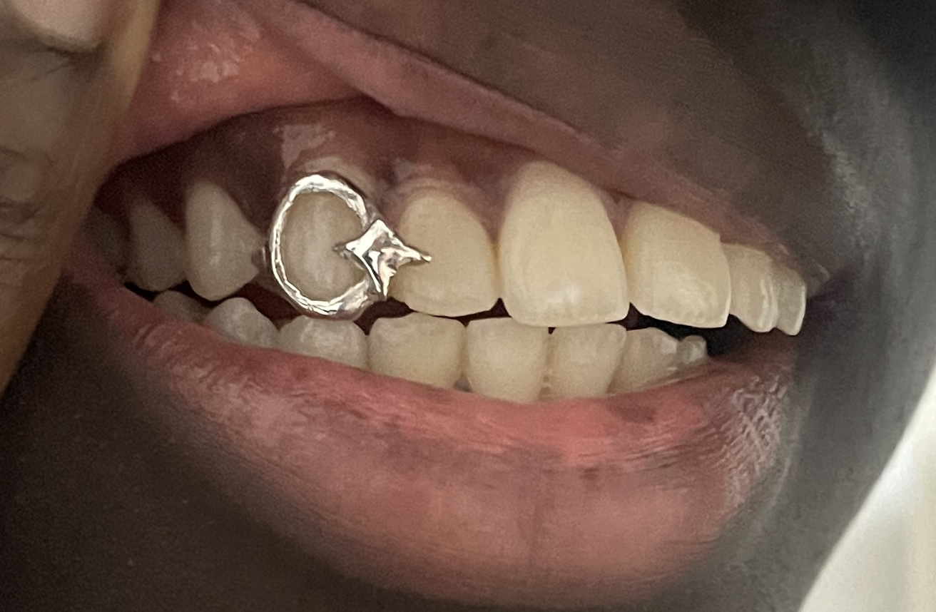 Mini star grillz - Photo 1