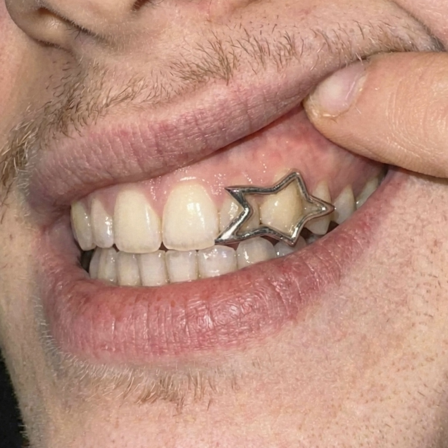 Big star grillz - Photo 1