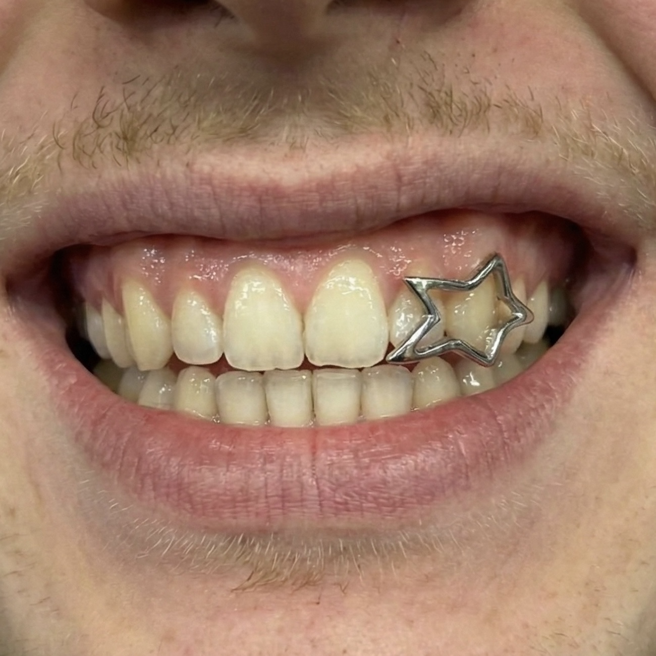 Big star grillz - Photo 2