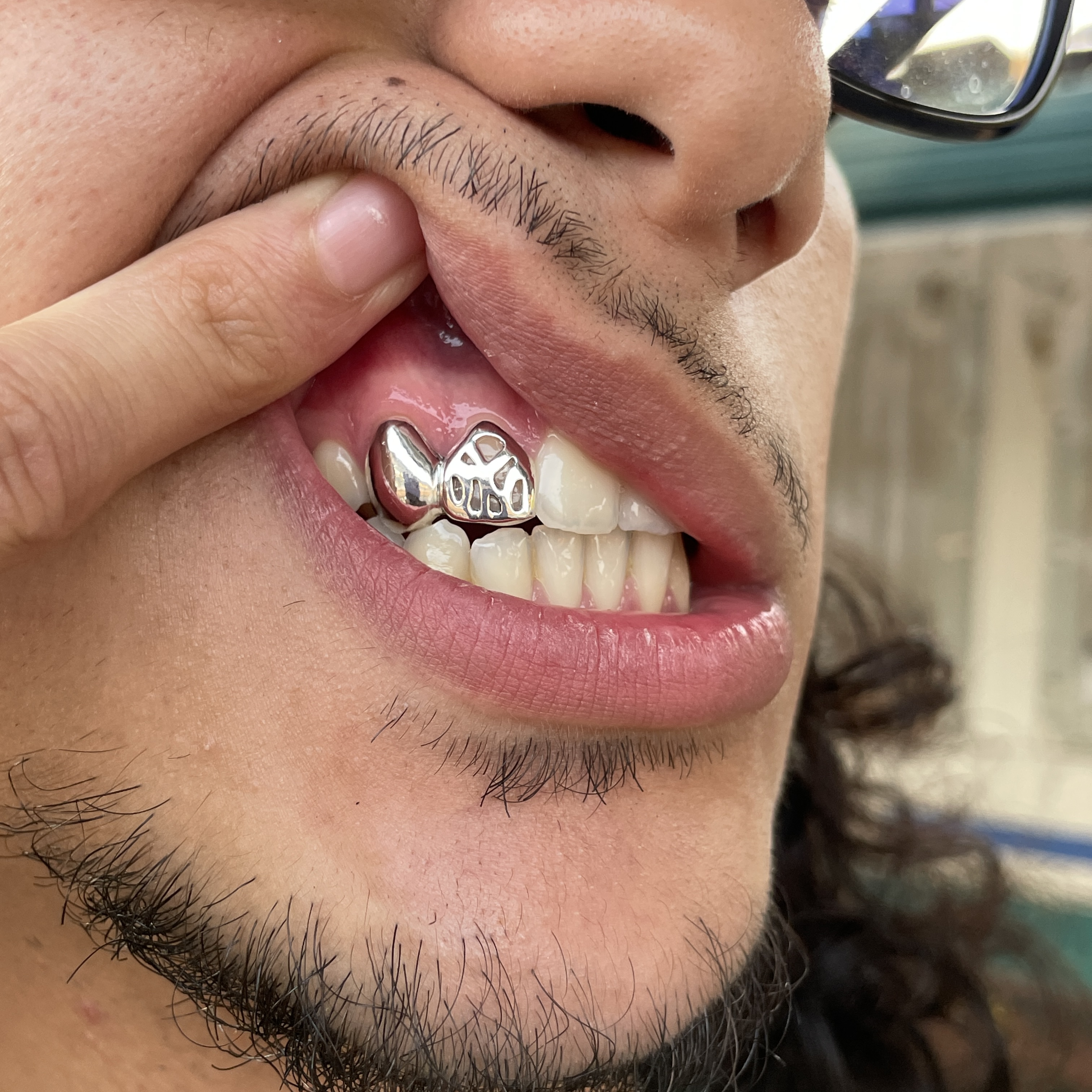 Ny Grillz 2 caps - Photo 1