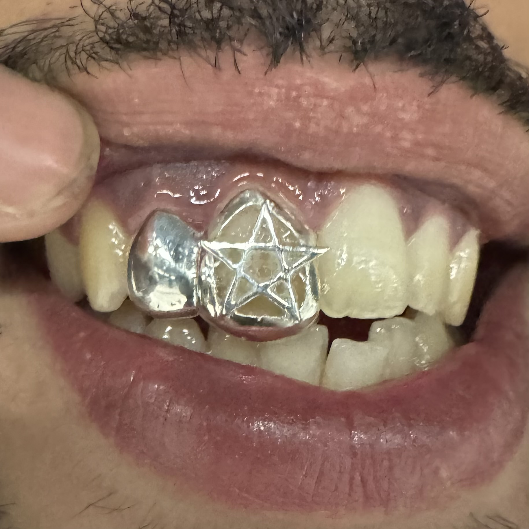 Morocco grillz - Photo 1