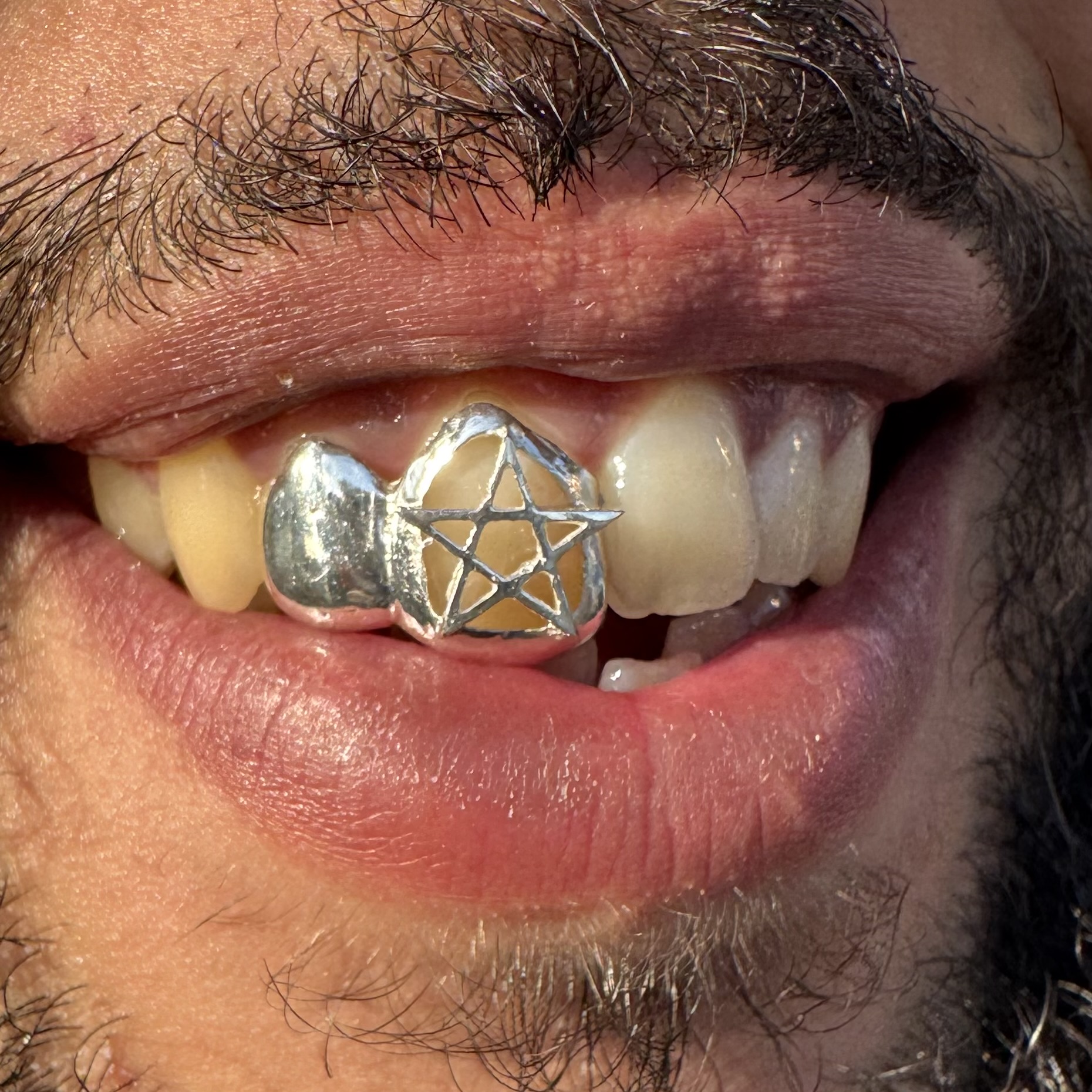Morocco grillz - Photo 2