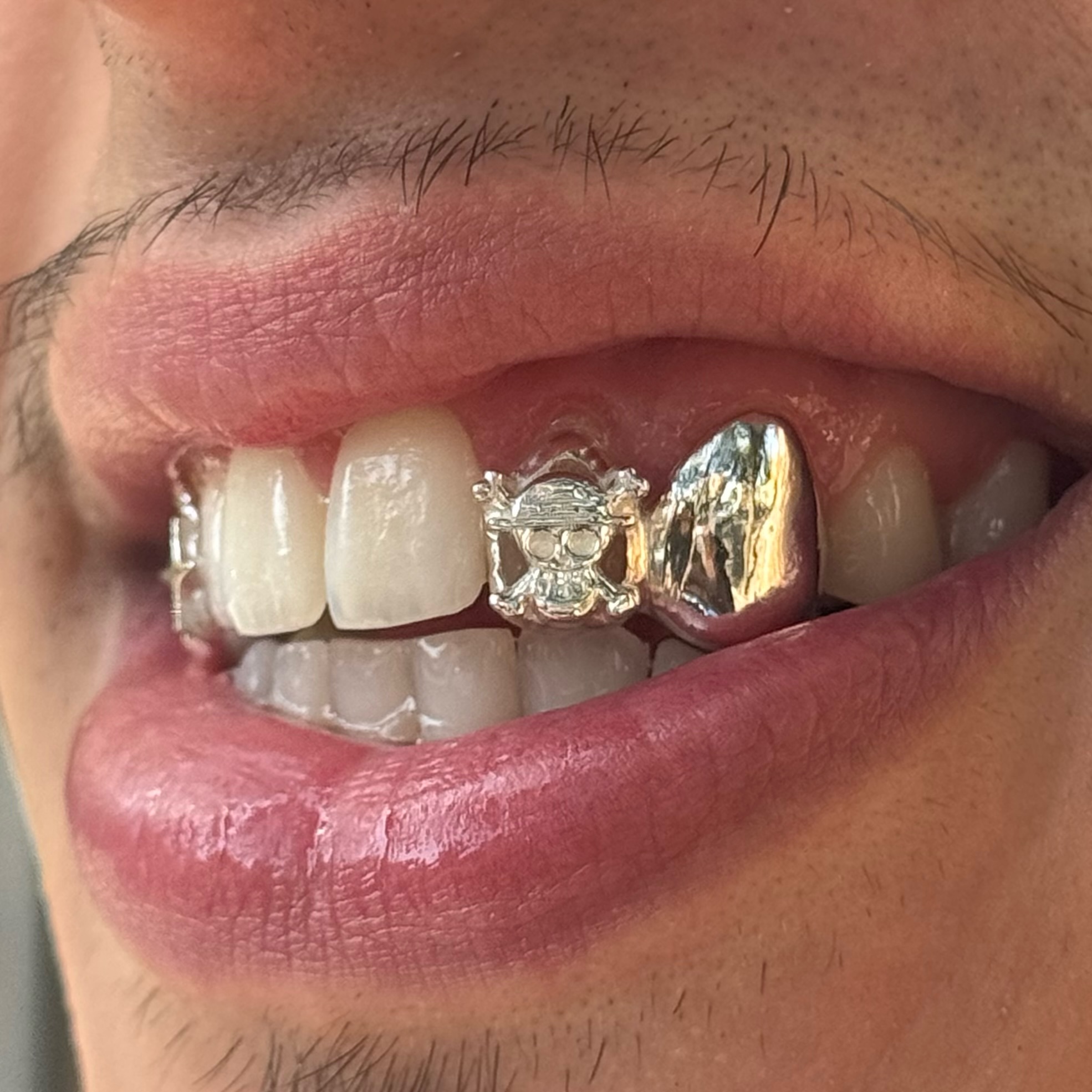 One piece grillz - Photo 1